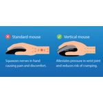 Q-Connect Erg Wls Vertical Rh Mouse
